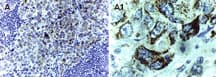 BIRC5 / Survivin Antibody