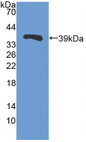 TFF3 / Trefoil Factor 3 Antibody (aa22-80, Cy3)