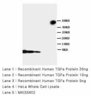 TGFA / TGF Alpha Antibody (aa73-90)