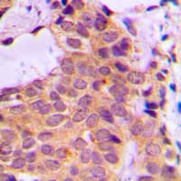 Polyclonal Rabbit anti-Human PRKCZ / PKC-Zeta Antibody (C-Terminus, IHC, IF, WB)