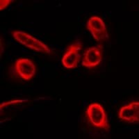 SLC22A11 Antibody