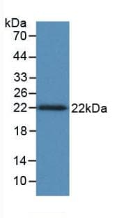 tnfb Antibody