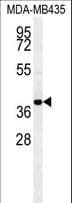 Polyclonal Rabbit anti-Human CCR8 / CD198 Antibody (aa305-335, WB)