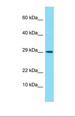 Polyclonal Rabbit anti-Human LIMS3 Antibody (aa20-69, WB)