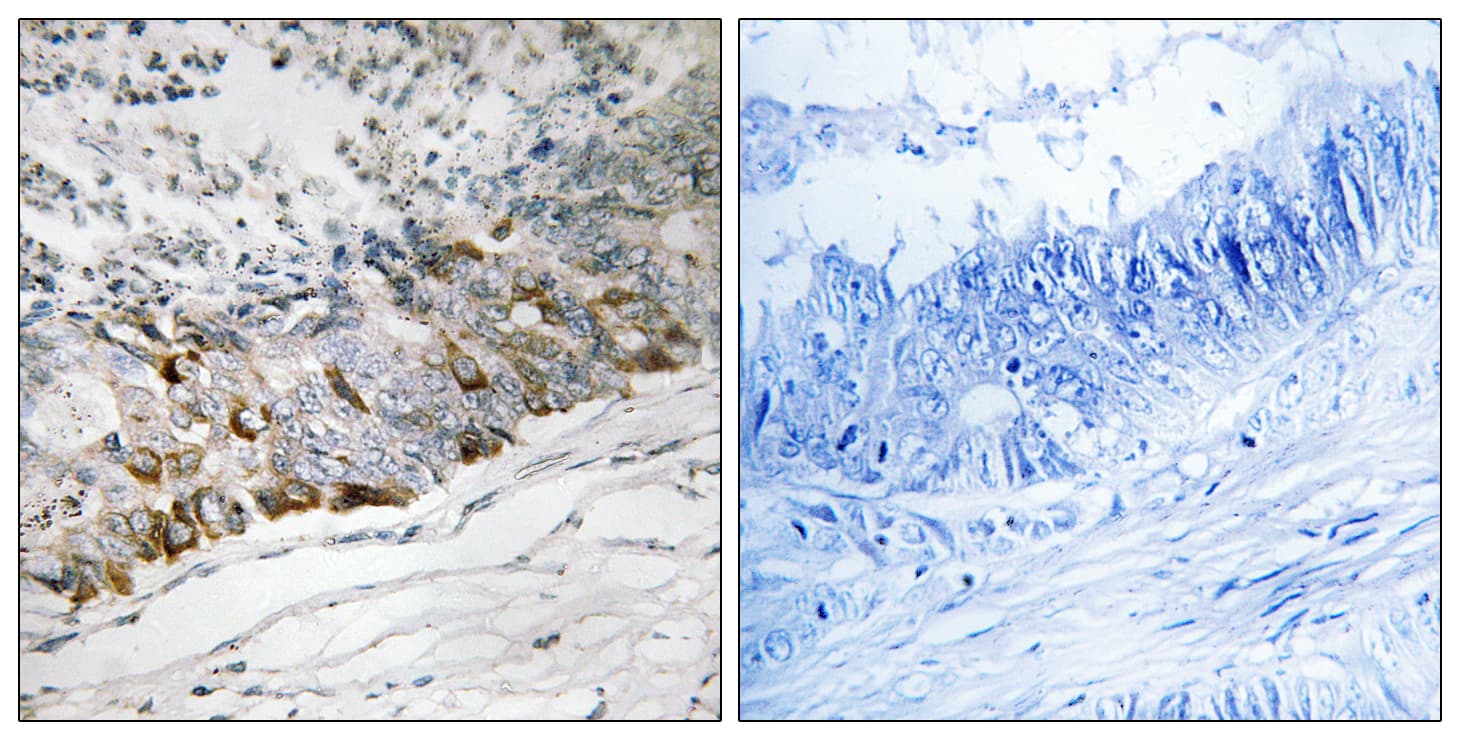 GCHFR Antibody (aa31-80)
