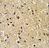Polyclonal Rabbit anti-Human ZNF823 Antibody (aa119-148, IHC, WB)