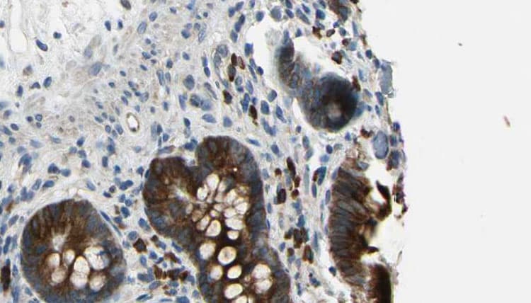 Polyclonal Rabbit anti-Human c-CBL Antibody (IHC, IF, WB)