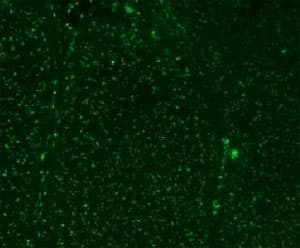 Nuclear Membrane Marker NM97 Antibody (clone NM95)