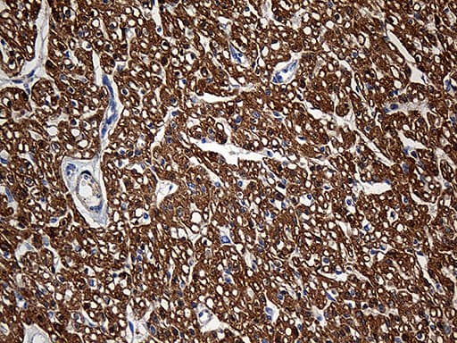 SH3BGR Antibody (clone OTI1G7)