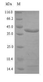 Spiroplasma citri spi Protein (Recombinant 6His-SUMO, N-terminus)