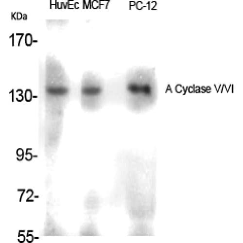Polyclonal Rabbit anti-Human ADCY5+6 Antibody (900-980 aa, C-terminal, IHC, IF, WB)