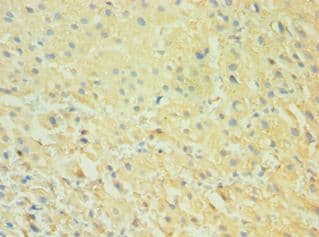Polyclonal Rabbit anti-Human CALHM1 Antibody (aa202-346, IHC)