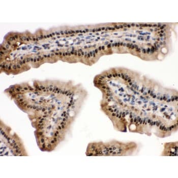 Polyclonal Rabbit anti-Human MAPK13 / p38delta Antibody (aa332-365, IHC, WB)