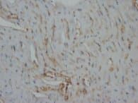 DES / Desmin Antibody (clone DES-82, Magnetic beads)