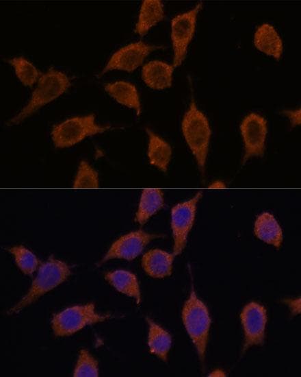 SEC23IP / p125 Antibody