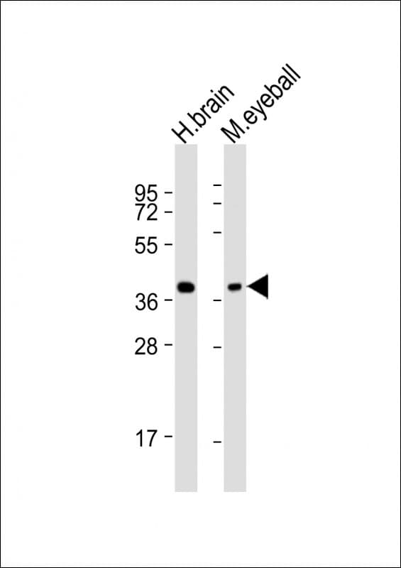ARR3 / Cone Arrestin Antibody (aa77-109)