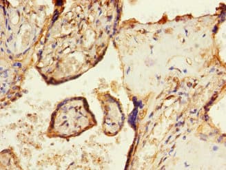SOCS6 / SOCS-6 Antibody