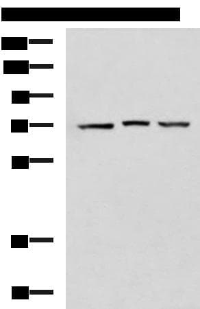 DHX58 / LGP2 Antibody