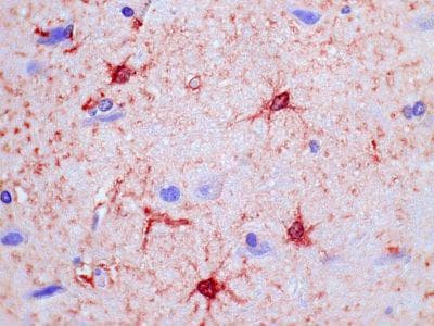 Monoclonal Mouse anti-Human GPR19 Antibody (clone 1B5, IHC)