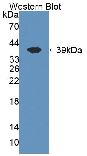 CISH / SOCS Antibody (aa1-258)
