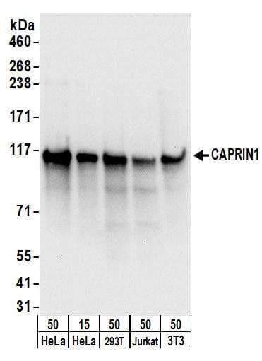 PSMD4 / RPN10 Antibody (aa250-300)