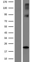SLC38A6 Protein (Over-Expression Lysate Myc-DDK (Flag))