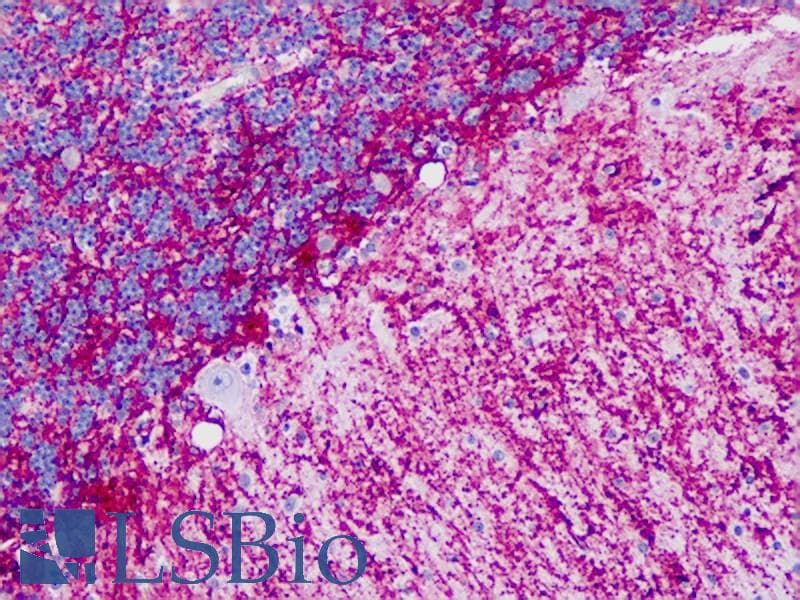 PathPlus™ Polyclonal Rabbit anti-Human GRIN2B / NMDAR2B / NR2B Antibody (aa1435-1484, IHC, WB)
