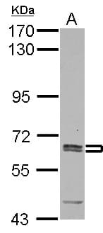 IHC-plus™ ASNS Antibody