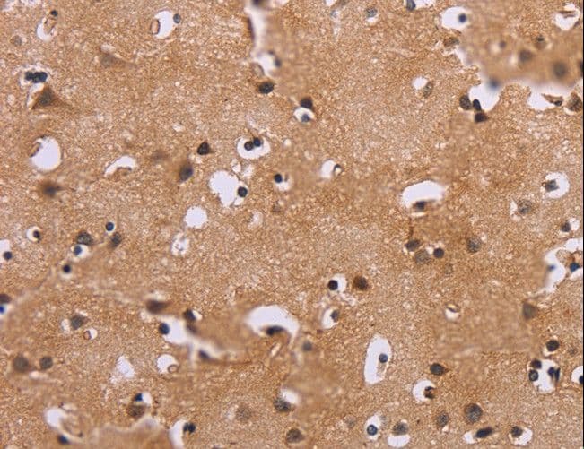 ERK1 + ERK2 Antibody