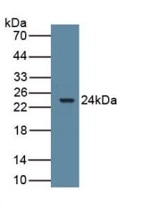 CYP19 / Aromatase Antibody (PE)