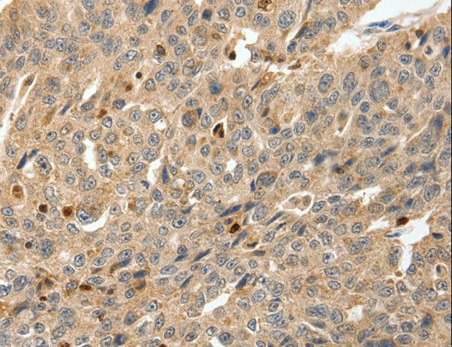 S100A4 / FSP1 Antibody