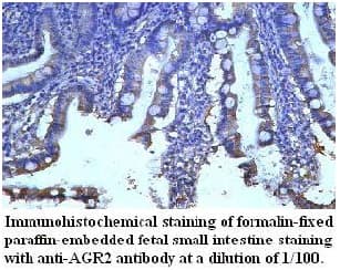AGR2 Antibody (aa21-175)