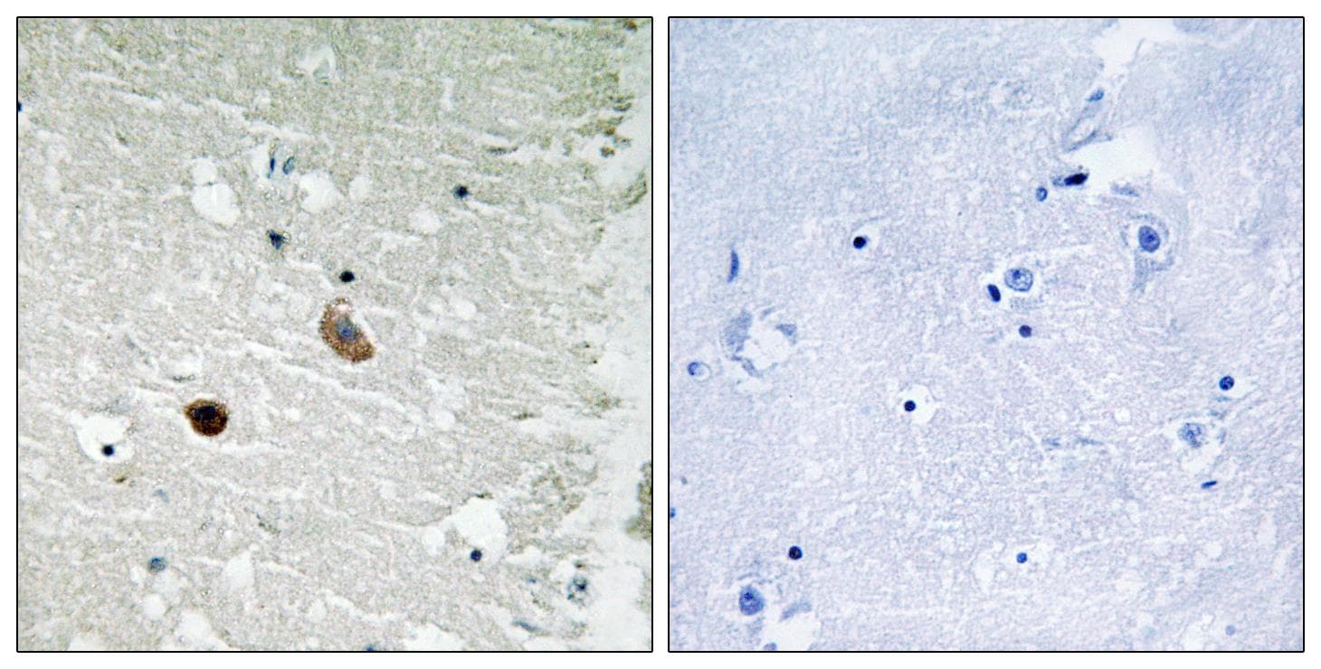 Polyclonal Rabbit anti-Human CaMKII Beta+Gamma+Delta Antibody (Ab-287, IHC, WB)