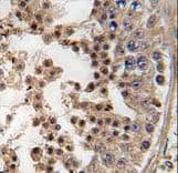 Polyclonal Rabbit anti-Human PFTK1 / CDK14 Antibody (aa1-30, IHC, WB)
