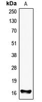 FHIT Antibody (Internal)