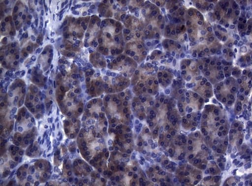 Monoclonal Mouse anti-Human FOXO3 / FOXO3A Antibody (clone OTI5F11, aa374-673, IHC, WB)
