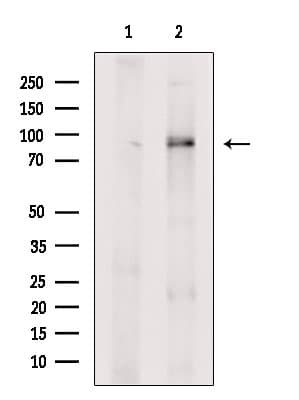 Polyclonal Rabbit anti-Human ARHGAP10 Antibody (IF, WB)