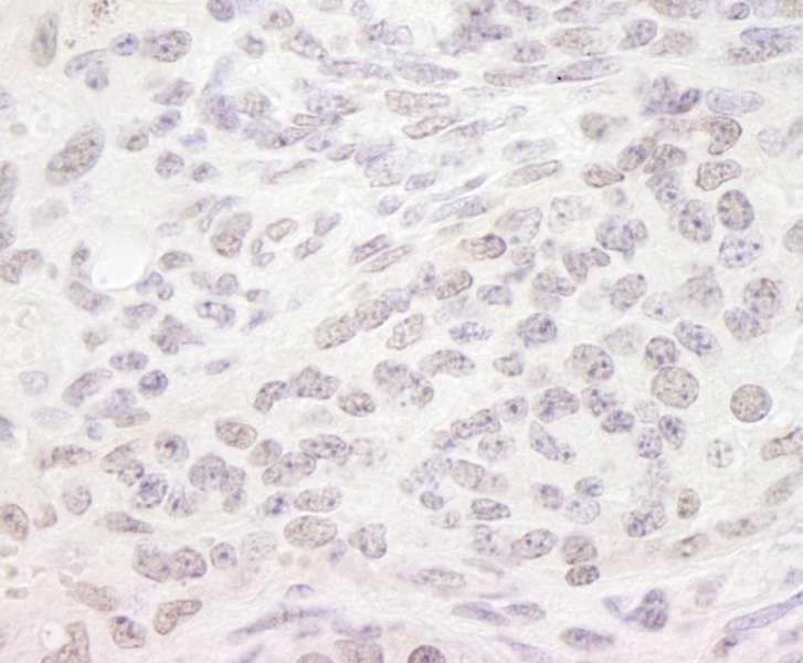 Polyclonal Rabbit anti-Human SMEK1 Antibody (aa770-C-term, IHC, IF)