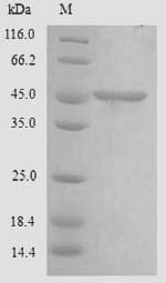 Human CHID1 Protein (Recombinant 6His, N-terminus)