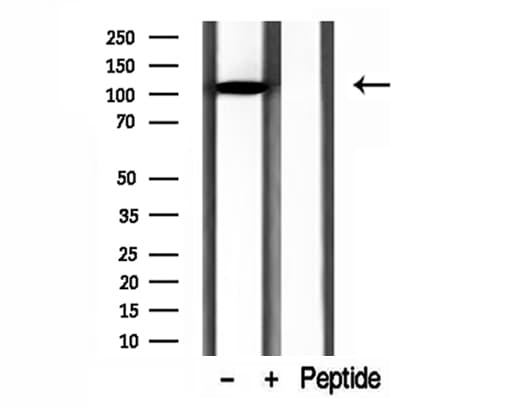 DIAPH3 / MDIA2 Antibody