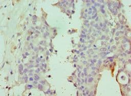 Dipeptidylpeptidase 8 / DPP8 Antibody (aa10-230)