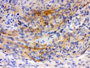 GAP43 Antibody (aa216-238)