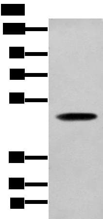 SERPINH1 / HSP47 Antibody