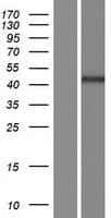 PPP6C Protein (Over-Expression Lysate Myc-DDK (Flag))