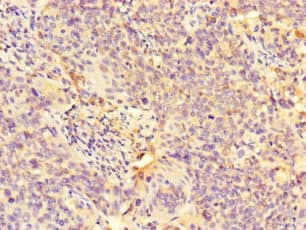 Polyclonal Rabbit anti-Human GALNT11 Antibody (IHC, IF)