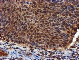Complement C1s Antibody (clone OTI4E3)
