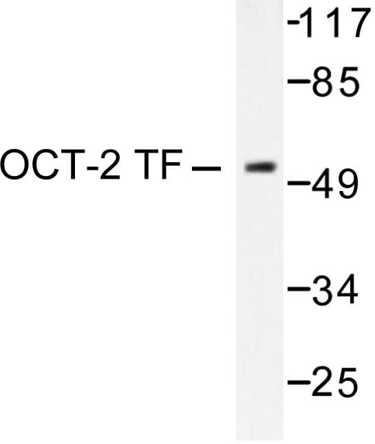 Polyclonal Rabbit anti-Human POU2F2 / OCT2 Antibody (His3, IHC, IF, WB)