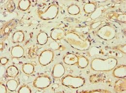 IHC-plus™ BBS4 Antibody (aa350-519)