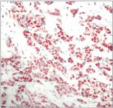 NFKB2 Antibody