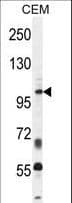 INPP5B Antibody (aa950-979)